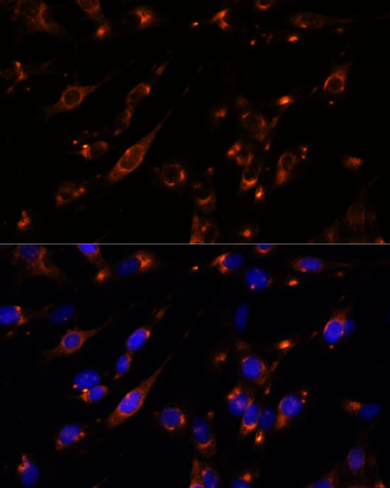 Anti-PTP4A2 Antibody (CAB15335)