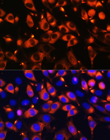 Anti-B9D1 Polyclonal Antibody (CAB7973)