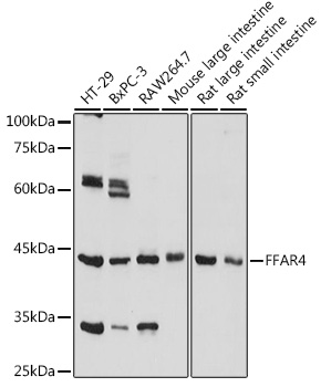 Anti-FFAR4 Antibody (CAB18689)