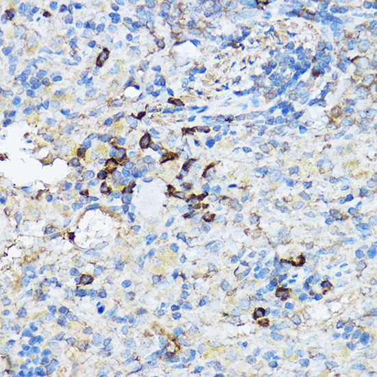 Anti-Caspase-3 Antibody (CAB11319)