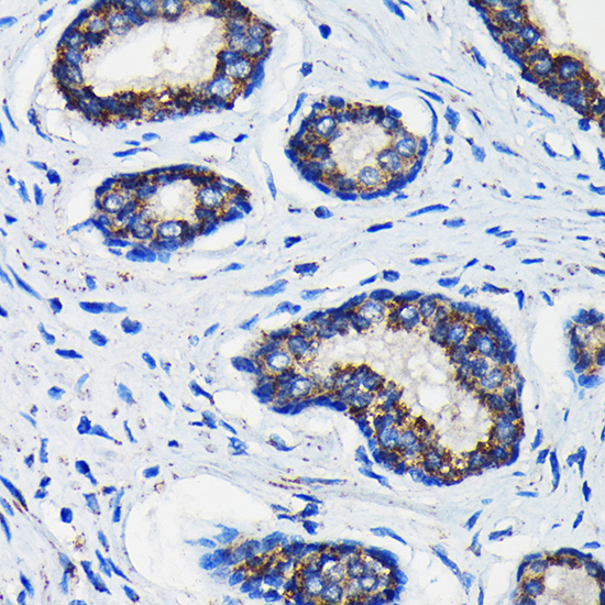 Anti-AMACR Antibody (CAB1130)