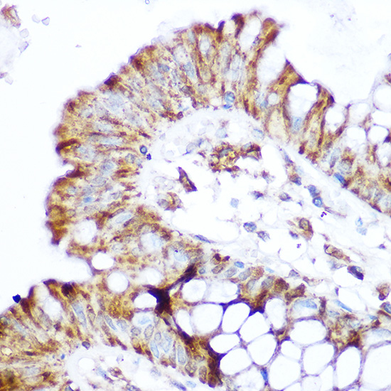 Anti-NOD2 Antibody (CAB15992)