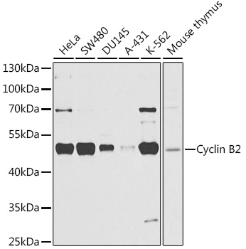 Anti-Cyclin B2 Antibody (CAB3351)