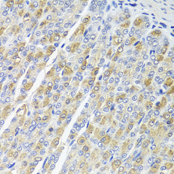 Anti-OSGEPL1 Polyclonal Antibody (CAB8022)