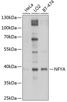 Anti-NFYA Antibody (CAB1998)