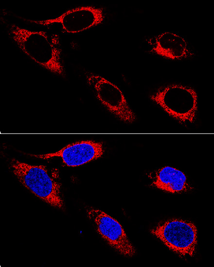 Anti-P4HB Antibody [KO Validated] (CAB0692)