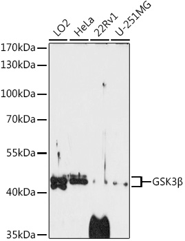 Anti-GSK3Beta Antibody [KO Validated] (CAB3174)