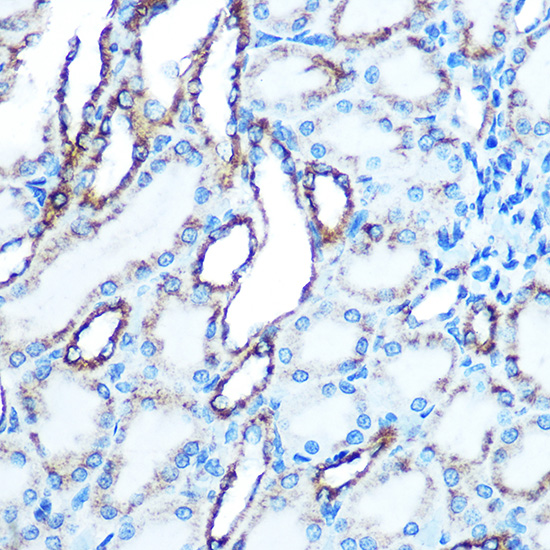 Anti-E-Cadherin Antibody (CAB11492)