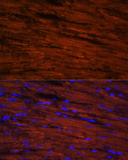 Anti-LDB3 Antibody (CAB7462)