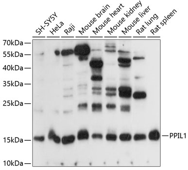 Anti-PPIL-1 Antibody (CAB14892)