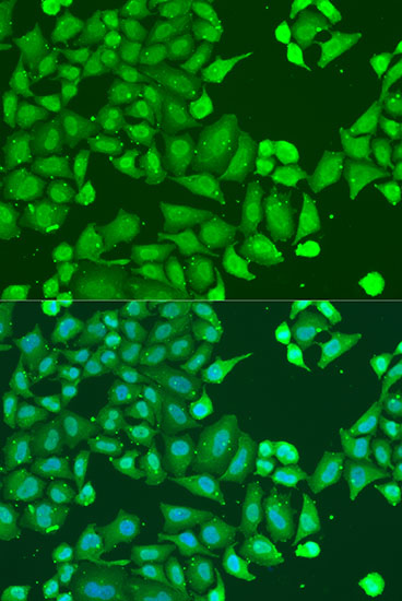 Anti-GNAI3 Antibody (CAB15674)