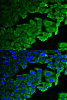 Anti-RPLP0 Antibody (CAB5557)