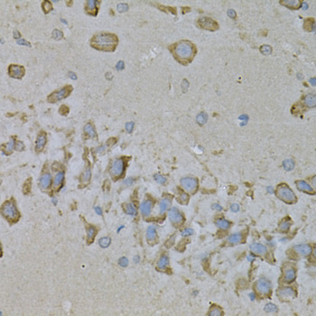 Anti-IL-10RA Antibody (CAB1830)