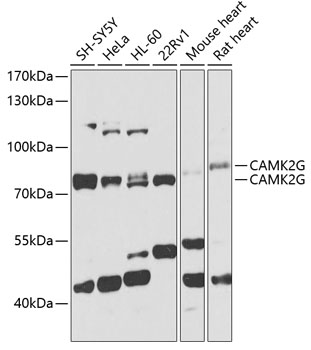 Anti-CAMK2G Antibody (CAB3231)