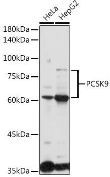 Anti-PCSK9 Antibody (CAB7860)