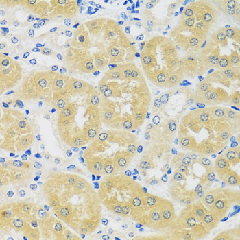 Anti-C1GALT1 Antibody (CAB12865)