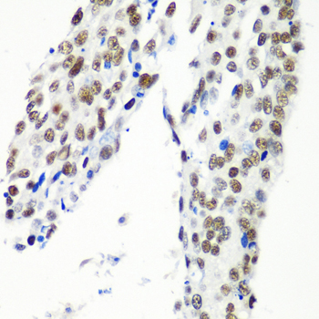 Anti-HTATSF1 Antibody (CAB5977)