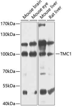 Anti-TMC1 Antibody (CAB12609)