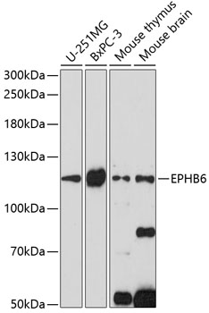 Anti-EPHB6 Antibody (CAB14728)