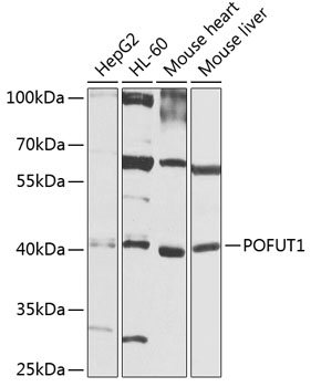 Anti-POFUT1 Polyclonal Antibody (CAB8338)