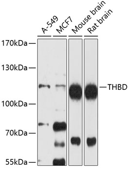 Anti-THBD Antibody (CAB4155)