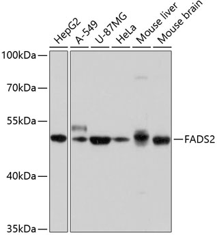 Anti-FADS2 Antibody (CAB10270)