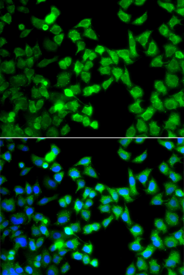 Anti-DCP1A Antibody (CAB7376)