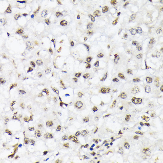 Anti-Phospho-FoxO1-T24/FoxO3a-T32/FoxO4-T28 pAb (CABP0892)