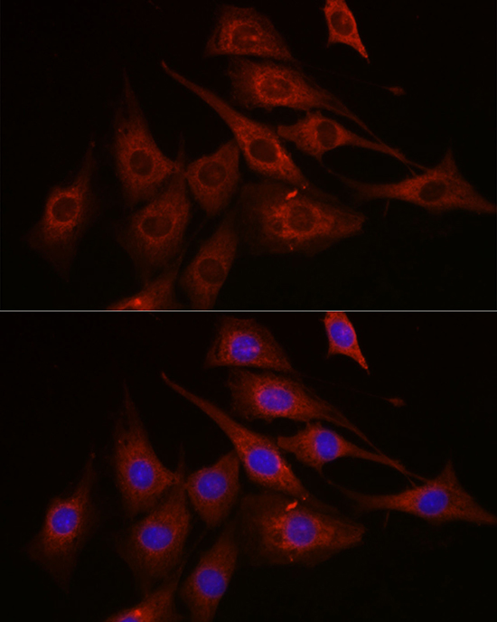 Anti-mTOR Antibody (CAB11355)