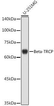 Anti-Beta-TRCP Antibody (CAB1656)