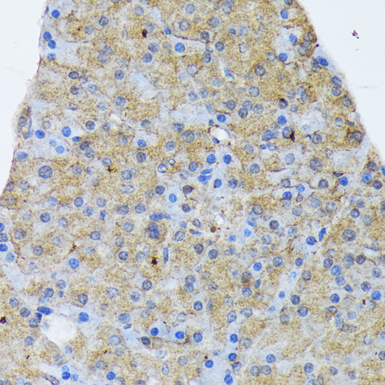 Anti-IRS1 Antibody (CAB16902)