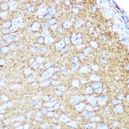 Anti-NCAM1 / CD56 Antibody (CAB7913)