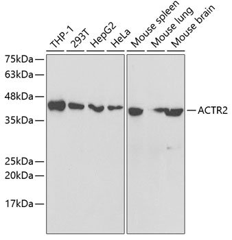 Anti-ACTR2 Antibody (CAB5734)