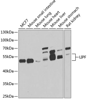 Anti-LIPF Antibody (CAB7016)
