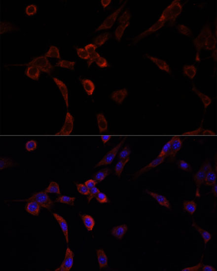 Anti-NRF1 Antibody (CAB14190)