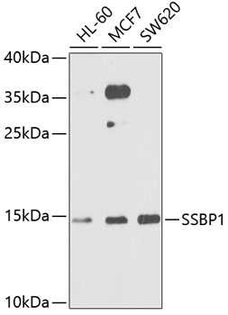 Anti-SSBP1 Antibody (CAB6987)