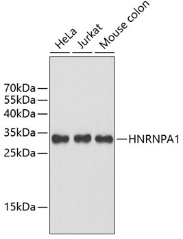 Anti-HNRNPA1 Antibody (CAB2622)