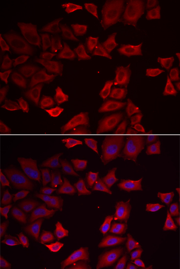 Anti-SEPHS1 Antibody (CAB6454)