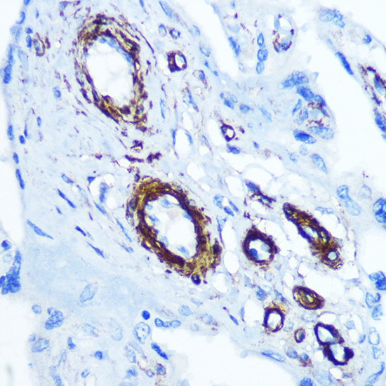 Anti-alpha smooth muscle actin Antibody (CAB7248)