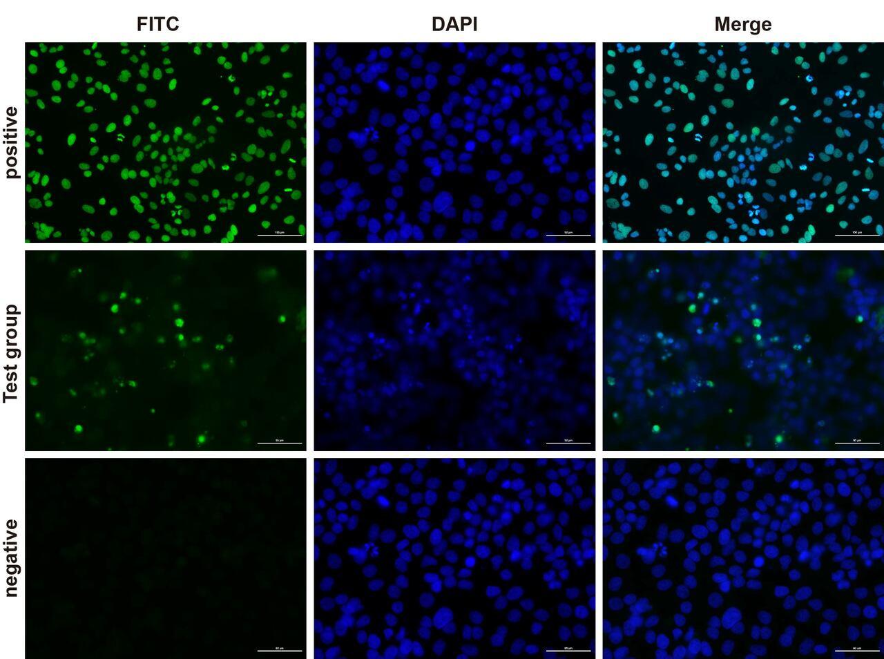 Fluorescence microscope analysis of camptothecin-induced apoptosis of Hela cells.