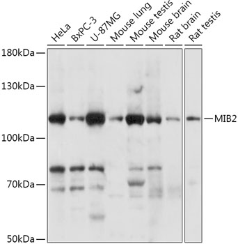 Anti-MIB2 Antibody (CAB17829)