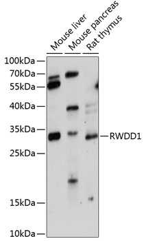 Anti-RWDD1 Polyclonal Antibody (CAB9237)