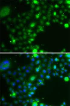 Anti-UBE2Z Antibody (CAB7225)