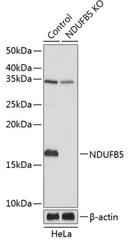 Anti-NDUFB5 Antibody [KO Validated] (CAB19953)