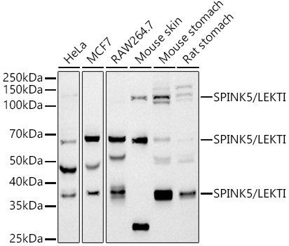 Western blot analysis of extracts of various cell lines, using SPINK5/LEKTI antibody at 1:1000 dilution. Secondary antibody: HRP Goat Anti-Rabbit IgG (H+L) at 1:10000 dilution. Lysates/proteins: 25ug per lane. Blocking buffer: 3% nonfat dry milk in TBST. Detection: ECL Basic Kit. Exposure time: 90s.