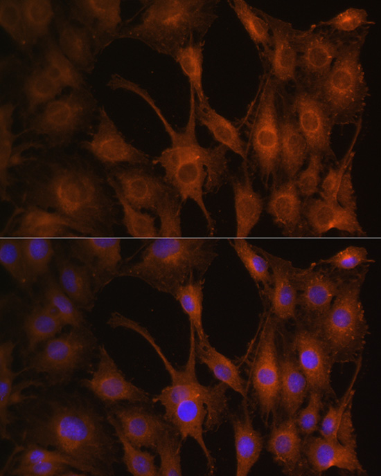 Anti-PFKM Antibody (CAB5477)