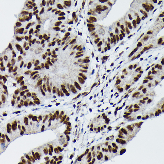 Anti-Phospho-JUN-S73 Antibody (CABP0119)