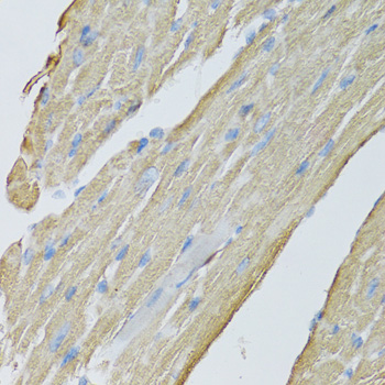 Anti-CKMT2 Polyclonal Antibody (CAB8088)