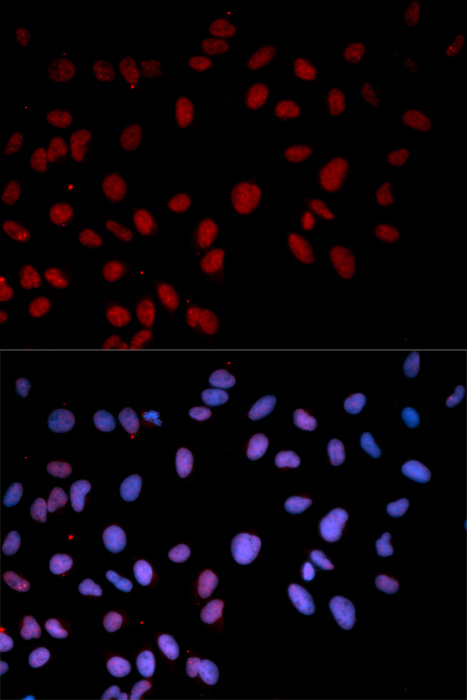 Anti-Phospho-MAPK14-T180 Antibody (CABP0056)