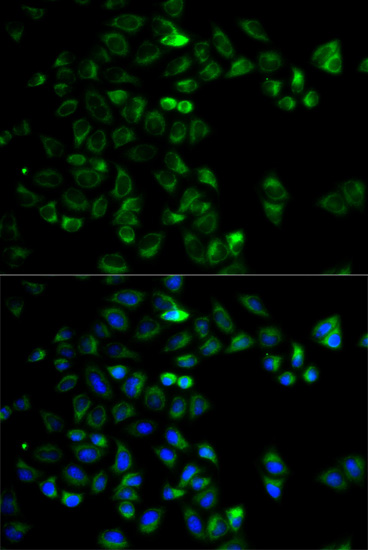 Anti-HTRA2 Antibody (CAB5762)